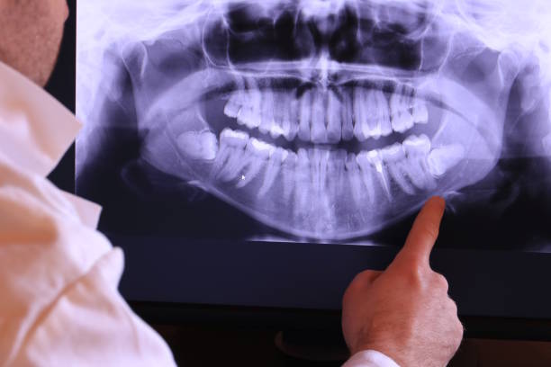 Best Pediatric Emergency Dentist in Ladera, CA